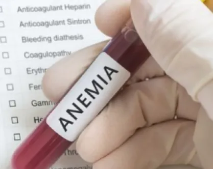 anemia